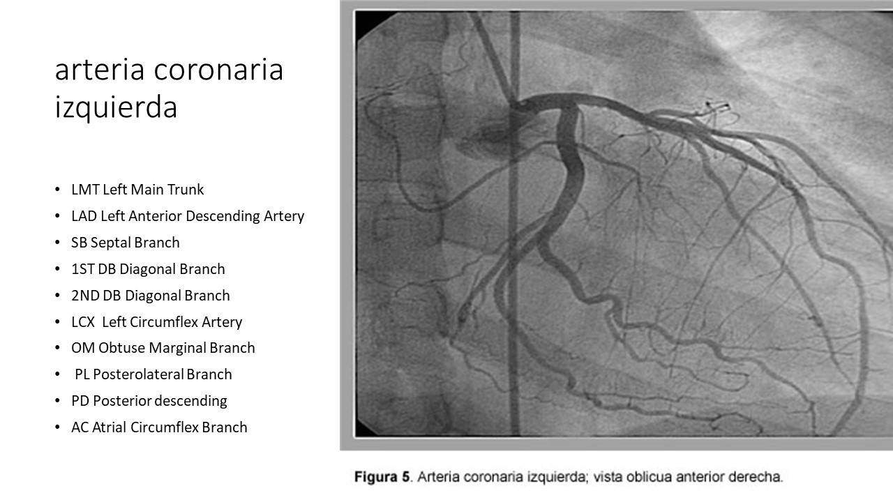 Anatomía radiológica de las arterias coronarias tras una cateterización cardíaca 3-CEA